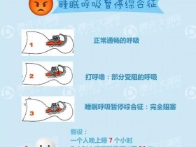 全国约5000万人睡眠中曾呼吸暂停个中原因让人心惊肉跳!