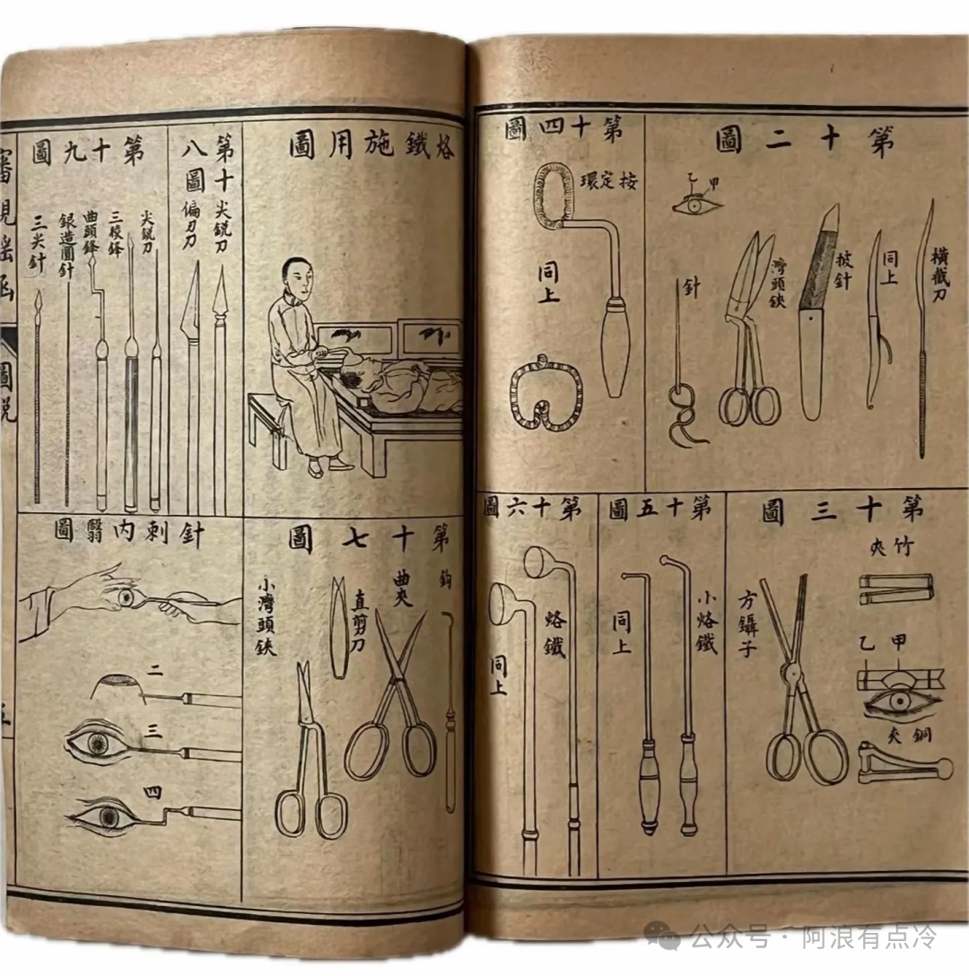 中医5000年手术史,被我们忘得一干二净