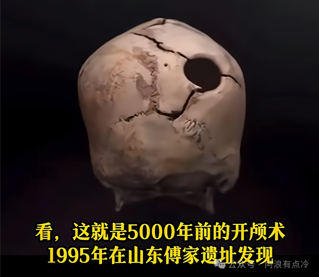 中医5000年手术史,被我们忘得一干二净